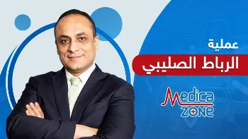 متى تحتاج للخضوع إلى عملية الرباط الصليبي؟